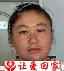 张 丽