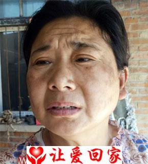 聂小辛