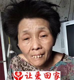严加林妻子