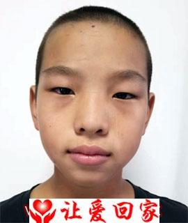 冯阳
