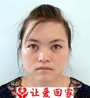 熊小花