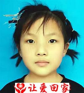 张佳媛