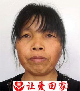 张广琼