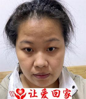 卞明芳