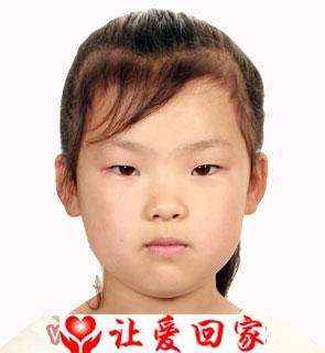 张佳慧