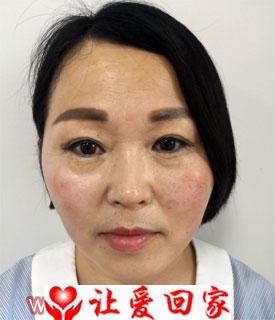 沈慧镜