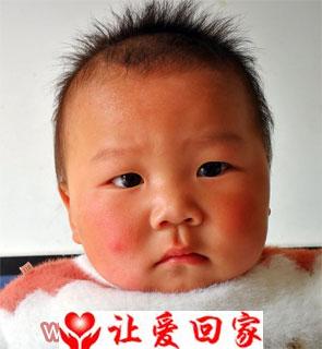 张默逸