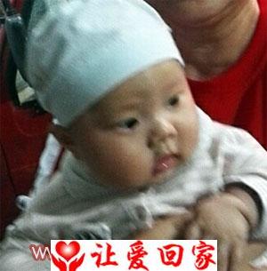 张先玲