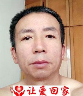 陈永锡