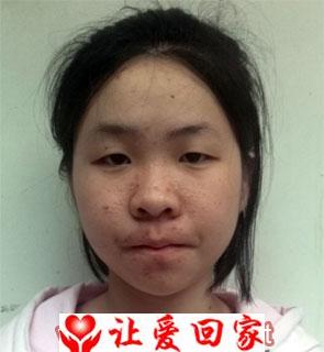 毛婷(随养父姓毛)